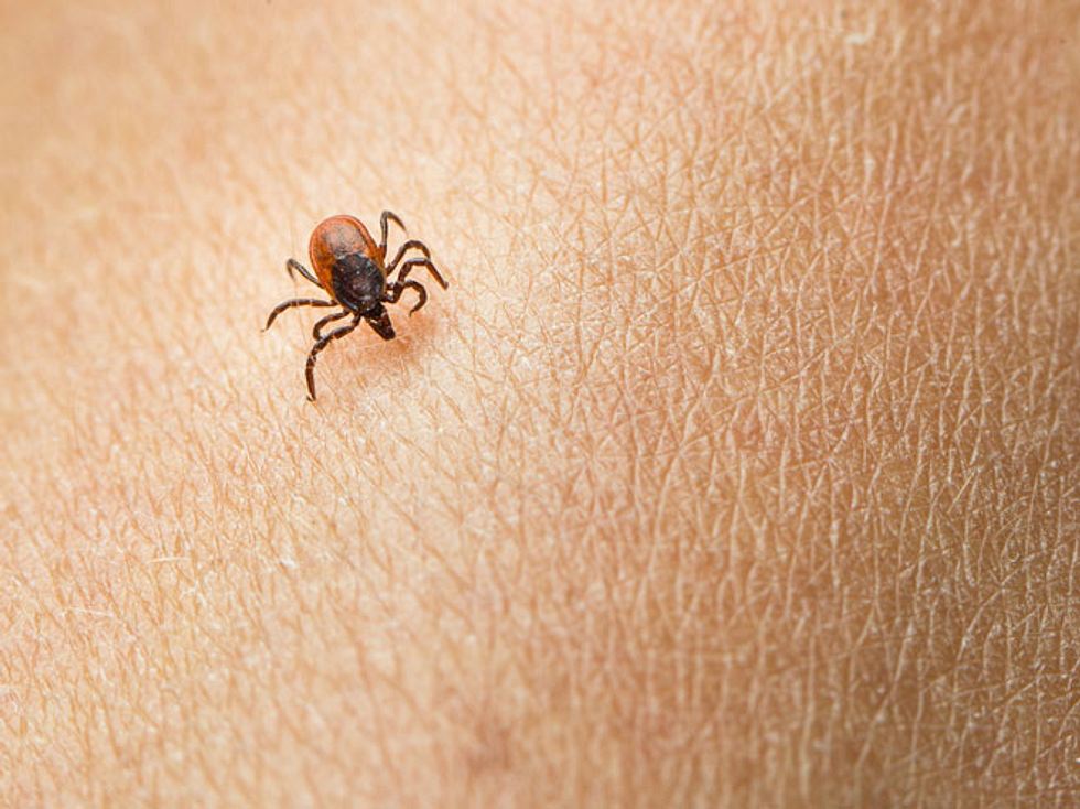 Zecken Krankheiten Wie Sie Fsme Borreliose Erkennen