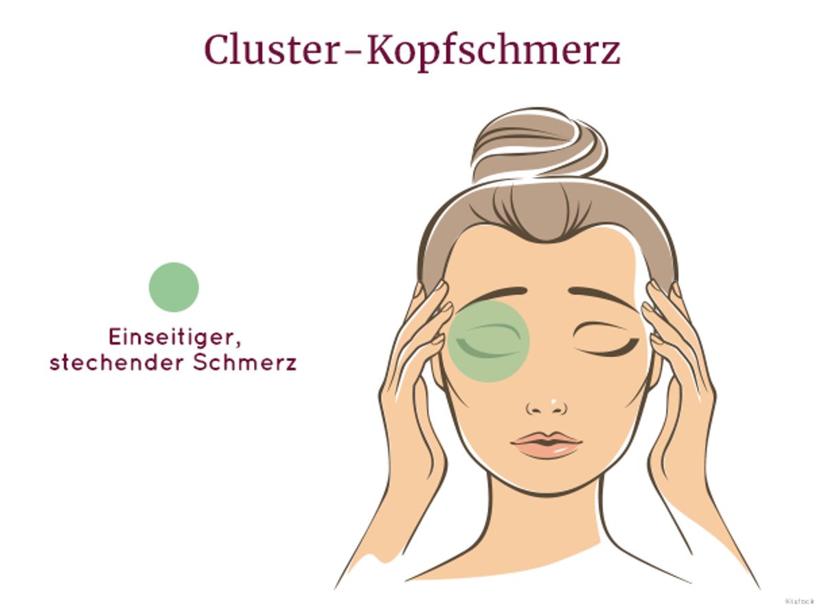 Cluster-Kopfschmerz äußert sich durch einseitigen Schmerz hinter dem Auge.