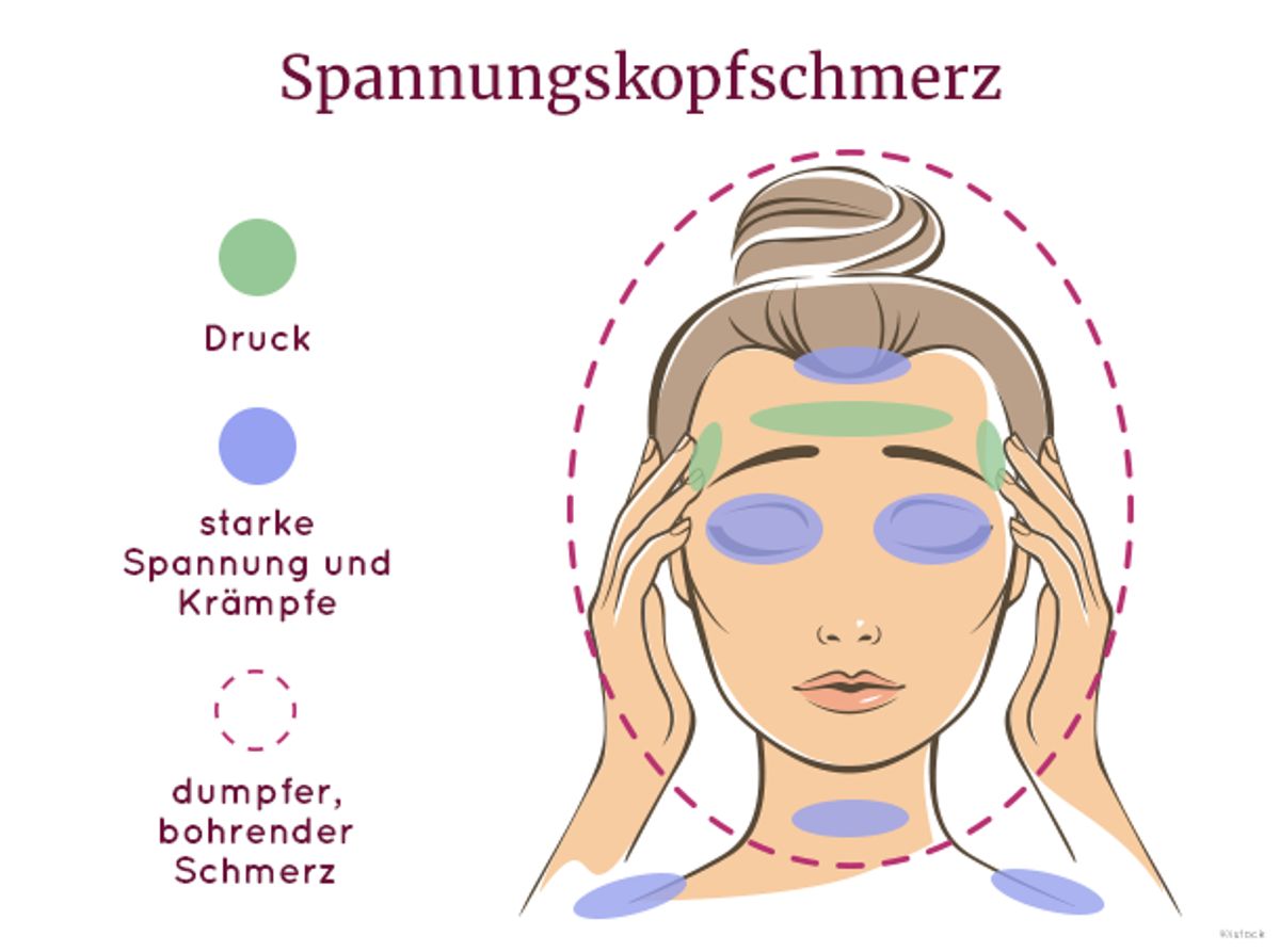 Cluster- oder Spannungskopfschmerz - wo ist der Unterschied?