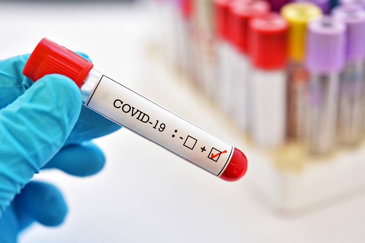 Das Coronavirus kann sich bei Infizierten ganz unterschiedlich äußern.