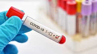 Das Coronavirus kann sich bei Infizierten ganz unterschiedlich äußern. - Foto: jarun011 / iStock