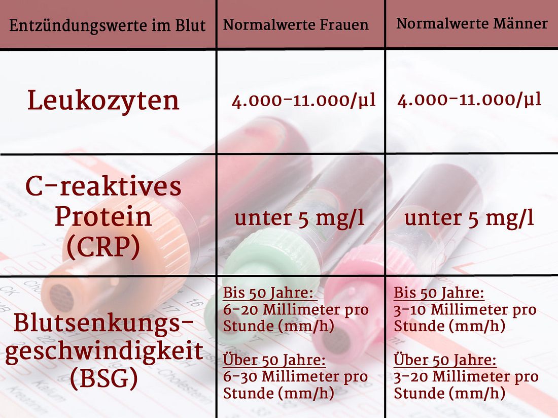 Bitte beachten Sie, dass die Normalwerte in Ihrem Laborbefund abweichend sein
können. Entscheidend ist immer der Referenzwert des Labors. Normalwerte der Entzündungsparameter