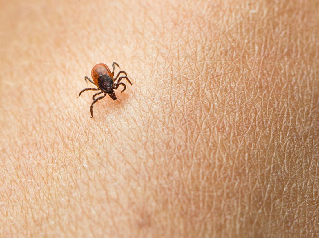 FSME und Borreliose: Was Zecken so gefährlich macht FSME und Borreliose: Was Zecken so gefährlich macht