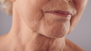 Untere Gesichtshälfte einer älteren Frau.  - Foto:  jacoblund / iStock 