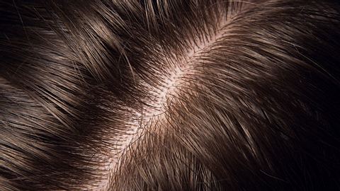 Scheitel mit dunklen Haaren.  - Foto: Fodor90 / iStock