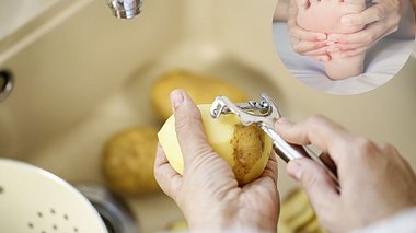Wundermittel gegen Hornhaut: Kartoffeln. - Foto: GMVozd / spukkato / iStock