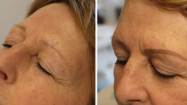Erfahrungsbericht vom Microblading: Der Vorher-Nachher-Vergleich  - Foto: Liebenswert