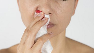 Mit diesen Tipps können Sie Nasenbluten stoppen. - Foto: solidcolours / iStock