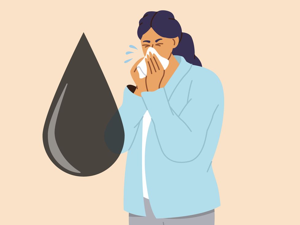 Eine Pilzinfektion kann schwarzes Nasensekret auslösen