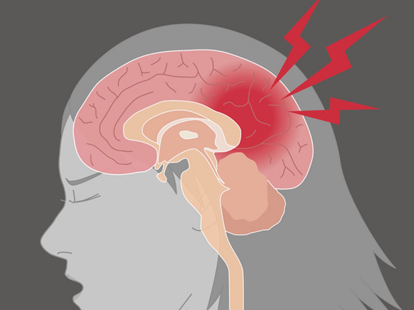 Симптомы сотрясения мозга у взрослых после удара макушки об полку