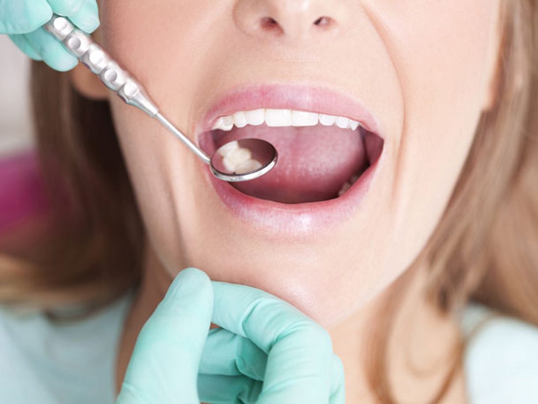Müssen wir bald nicht mehr zum Zahnarzt, um eine Füllung zu kriegen?