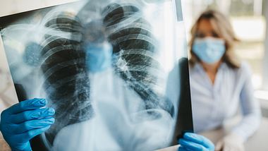 Zwei Personen betrachten eine Röntgenaufnahme der Lunge.  - Foto: bojanstory / iStock