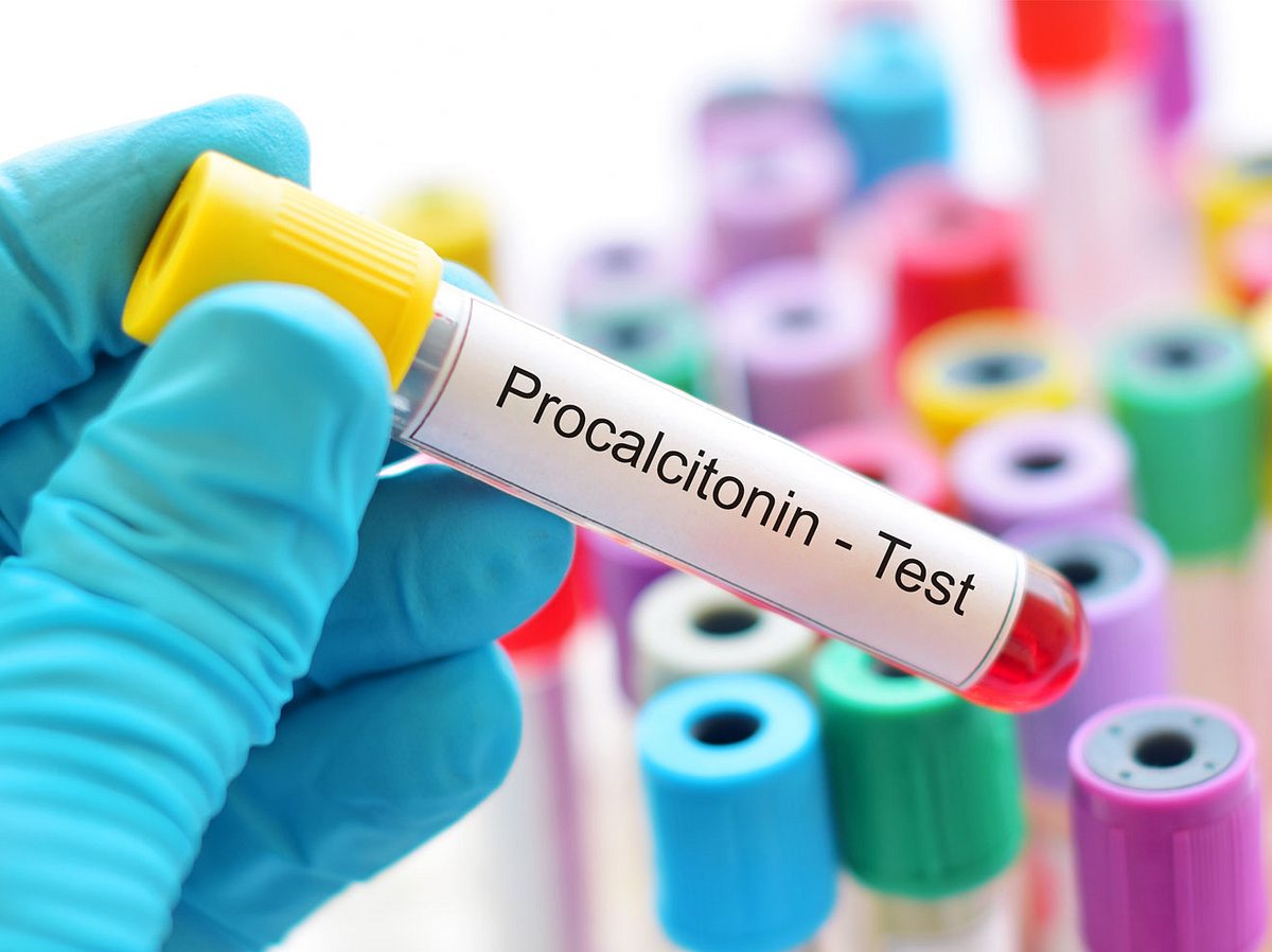 Procalcitonin-Test